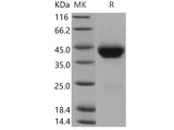 Recombinant Mouse CD38 Protein (His Tag)(Active)