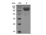 Recombinant Mouse CD39/ENTPD1 Protein (His Tag)