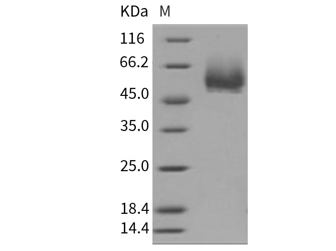 Recombinant Mouse CD4/LEU3 Protein (His Tag)(Active)