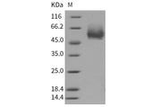 Recombinant Mouse CD4/LEU3 Protein (His Tag)(Active)