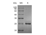 Recombinant Mouse CD40LG/TNFSF5 Protein (His Tag)(Active)
