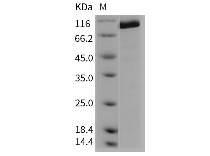 Recombinant Mouse CD45/PTPRC Protein (Active)