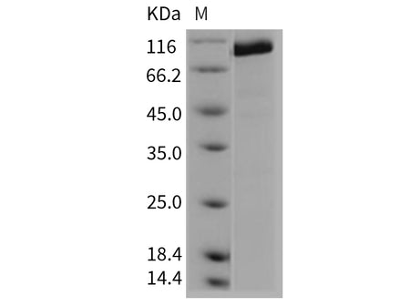 Recombinant Mouse CD45/PTPRC Protein (Active)