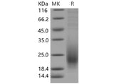 Recombinant Mouse CD53 Protein (aa 107-181, His Tag)