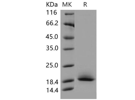 Recombinant Mouse CD59a/MAC-IP Protein (His Tag)