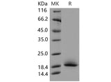 Recombinant Mouse CD59a/MAC-IP Protein (His Tag)