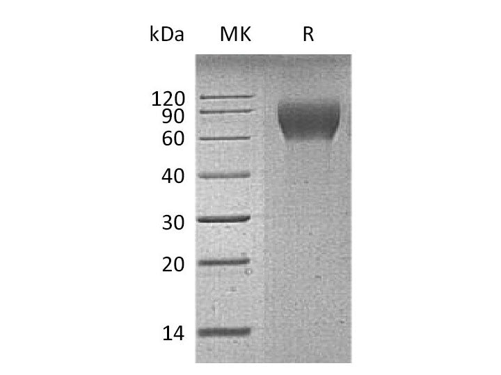 Recombinant Mouse CD6/TP120 Protein (His Tag)