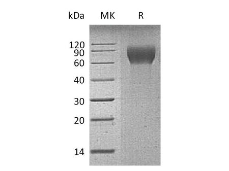 Recombinant Mouse CD6/TP120 Protein (His Tag)