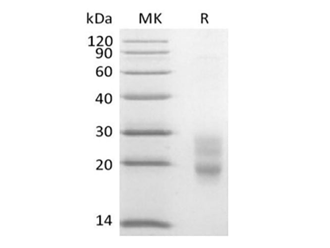 Recombinant Mouse CD7/Leu-9 (C-6His)