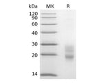 Recombinant Mouse CD7/Leu-9 (C-6His)