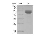 Recombinant Mouse CD79B/B29 (C-Fc)
