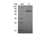 Recombinant Mouse CD83/HB15 Protein (aa 22-134, Fc Tag)