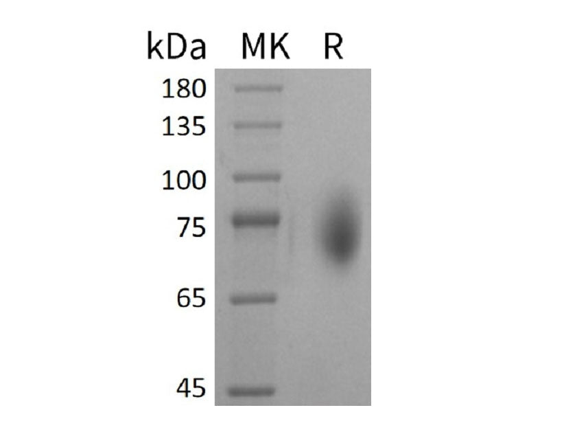 Recombinant Mouse CD86/B7-2 Protein (Fc Tag)
