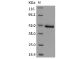 Recombinant Mouse CHI3L1/YKL40 Protein (His Tag)