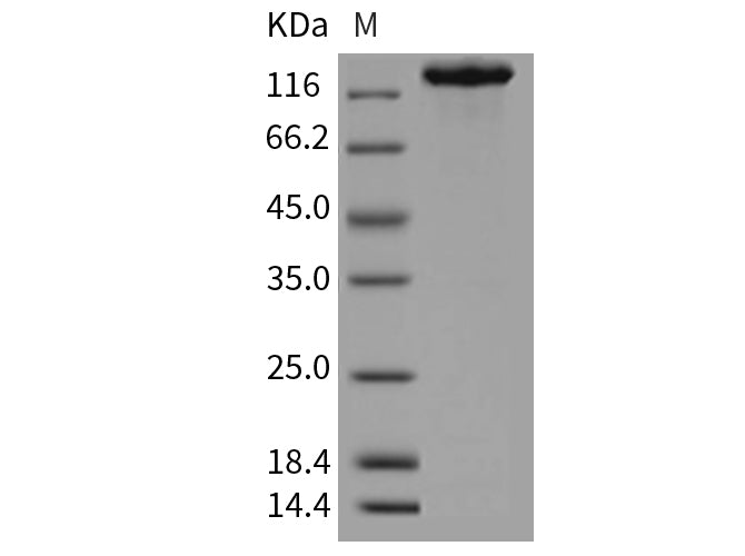 Recombinant Mouse CHL-1 Protein (Fc Tag)