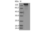 Recombinant Mouse CHL-1 Protein (His Tag)