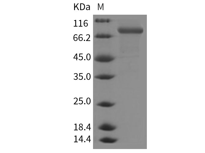 Recombinant Mouse CHST5/GST4 Protein (Fc Tag)