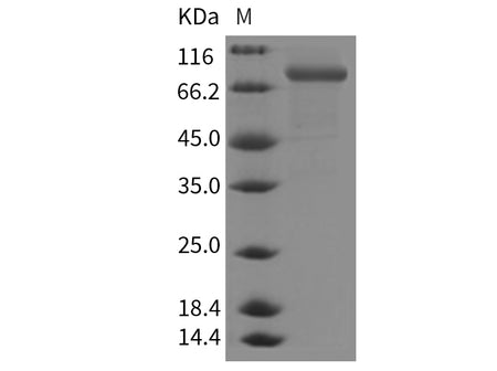 Recombinant Mouse CHST5/GST4 Protein (Fc Tag)