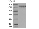 Recombinant Mouse CLEC14A/EGFR-5 Protein (His Tag)