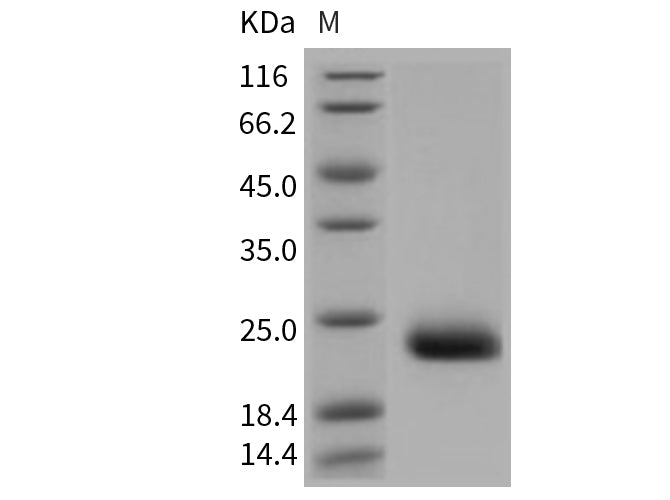 Recombinant Mouse CLEC6A/Dectin-2 Protein (His Tag)(Active)