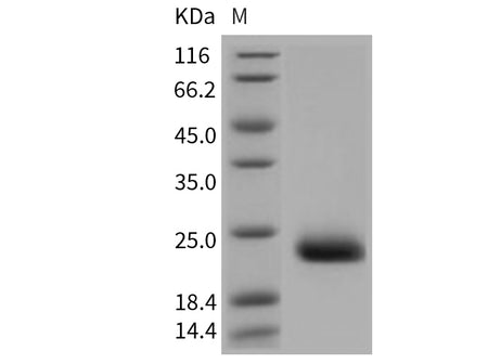 Recombinant Mouse CLEC6A/Dectin-2 Protein (His Tag)(Active)