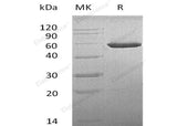 Recombinant Mouse CNDP2/CPGL/PEPA Protein (His Tag)(Active)
