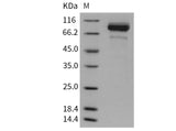 Recombinant Mouse Coagulation Factor II/FII/F2 Protein (His Tag)(Active)