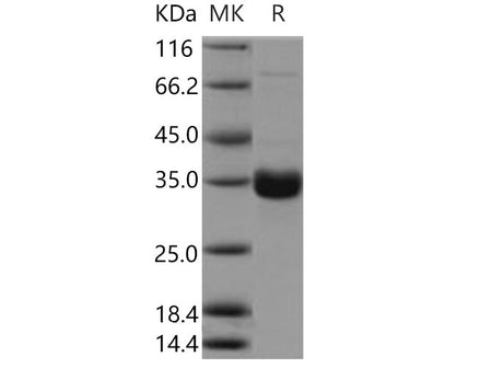 Recombinant Mouse Collectin-11/COLEC11 Protein (Baculovirus, His Tag)