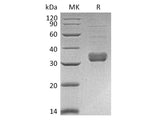 Recombinant Mouse Collectin-11/COLEC11 Protein (Human Cells, His Tag)