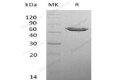 Recombinant Mouse CPA2 Protein (His Tag)(Active)