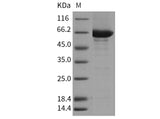 Recombinant Mouse CSK/C-Src kinase Protein (His & GST Tag)(Active)