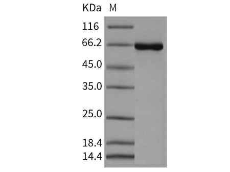 Recombinant Mouse CSNK2A1/CK2A1 Protein (His & GST Tag)(Active)