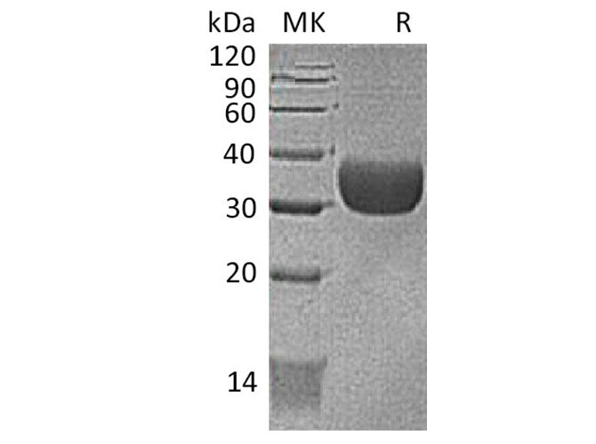 Recombinant Mouse CXADR/CAR Protein (AVI & His Tag)