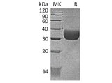 Recombinant Mouse CXADR/CAR Protein (AVI & His Tag)