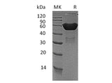 Recombinant Mouse CXADR/CAR Protein (Fc Tag)