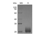 Recombinant Mouse CXCL9 Protein (His Tag)