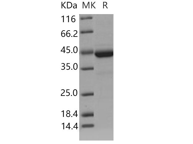 Recombinant Mouse Cystatin 7/CST7 Protein (Fc Tag)(Active)