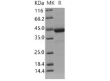 Recombinant Mouse Cystatin 7/CST7 Protein (Fc Tag)(Active)