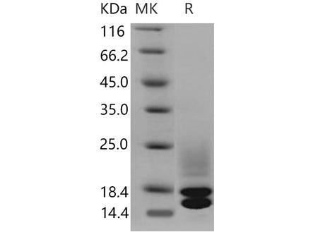 Recombinant Mouse Cystatin C/CST3 Protein (His Tag)(Active)