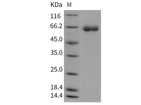 Recombinant Mouse DPP7/DPPII/DPP2 Protein (His Tag)(Active)