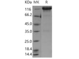 Recombinant Mouse EGFR Protein (Fc Tag)(Active)