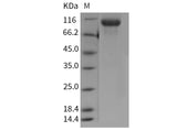 Recombinant Mouse EGFR Protein (His Tag)(Active)