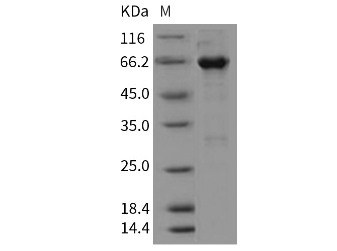 Recombinant Mouse EphA3 Protein (aa 569-984, His & GST Tag)(Active)
