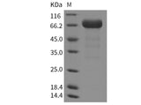 Recombinant Mouse EphA3 Protein (His Tag)(Active)