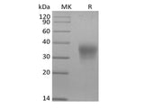Recombinant Mouse Erythropoietin/EPO (C-6His)