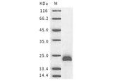 Recombinant Mouse ESM1/Endocan Protein (Baculovirus, His Tag)