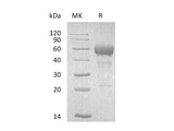 Recombinant Mouse FAS/TNFRSF6 Protein (Fc Tag)