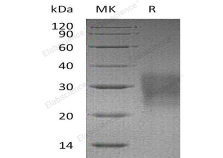 Recombinant Mouse FAS/TNFRSF6 Protein (His Tag)(Active)
