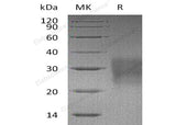 Recombinant Mouse FAS/TNFRSF6 Protein (His Tag)(Active)