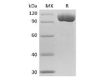 Recombinant Mouse FGCP/GCPII/mGCP/NAALADase I/PSMA(N-6His)
